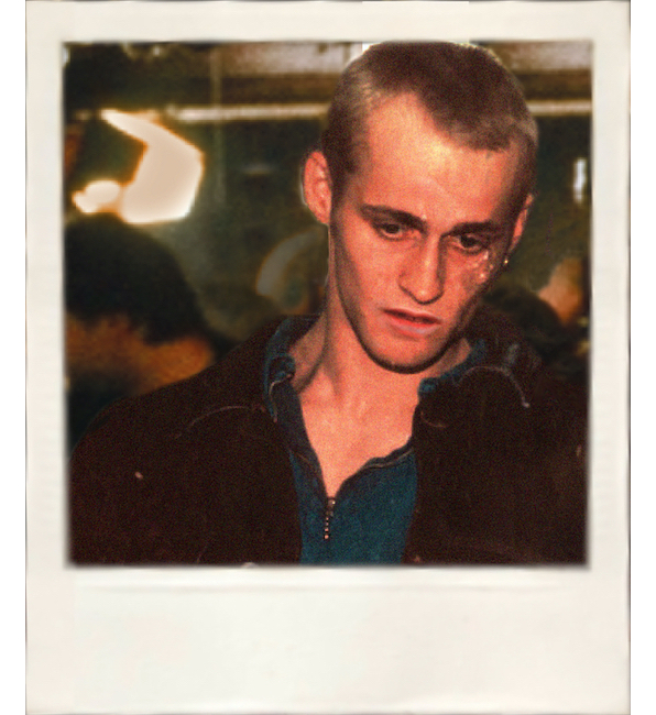 Alex mit Verletzung im Gesicht