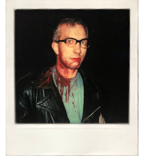 Randy blutüberströmt